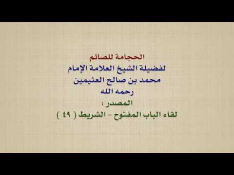 الشيخ ابن عثيمين : الحجامة للصائم