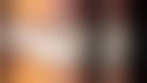 MAGNETIC ASSISTED LIVER RETRACTION IN BARIATRIC SURGERY