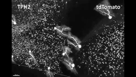 Purkinje neurons in the cerebellum imaged with a mesoSPIM