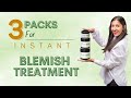 Blemish treatment at home  mystiq living blemish care kit