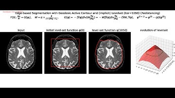 Edge-based Segmentation | Geodesic Active Contours | Snakes | Level Sets | Curvature Motion | python