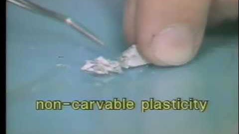 Introduction to Amalgam - Capmaster Tytin