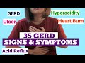 ALAMIN ang 35 Acid Reflux, GERD, Heartburn, Hyperacidity, Ulcer SIGNS and SYMPTOMS