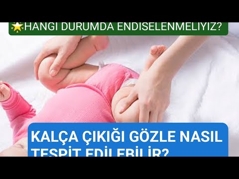 Bebeklere evde yapabileceğiniz doğal kalça çıkığı testi ! Yenidoğan fiziksel testleri nasıl yapılır