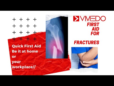 How to treat fractures | First Aid for Fractures