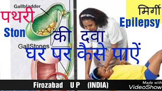 STON & EPILEPSY How to get medicine at home पित्त की थैली की पथरी और मिर्गी दौरा की दवा घर पर पाएं