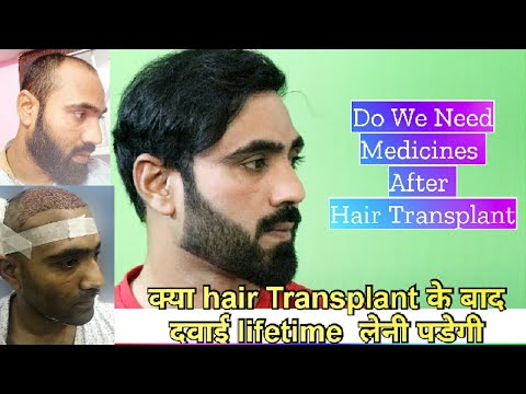 Medicine After Hair Transplant Surgery to Stop Hair Fall  Request Not to  Fight With Clinic  YouTube