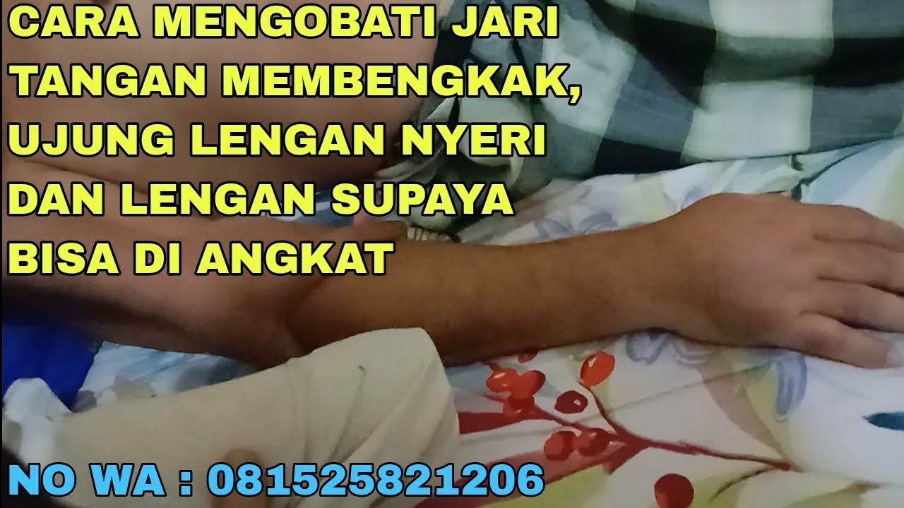 CARA MENGOBATI JARI TANGAN MEMBENGKAK, UJUNG LENGAN NYERI DAN LENGAN