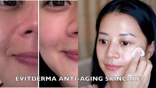 Evitderma Anti-Aging Skincare Review