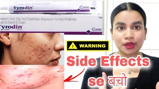 Tyrodin cream review | Skin lightening | Pigmentation removal | Fairness cream #brijwasigirl