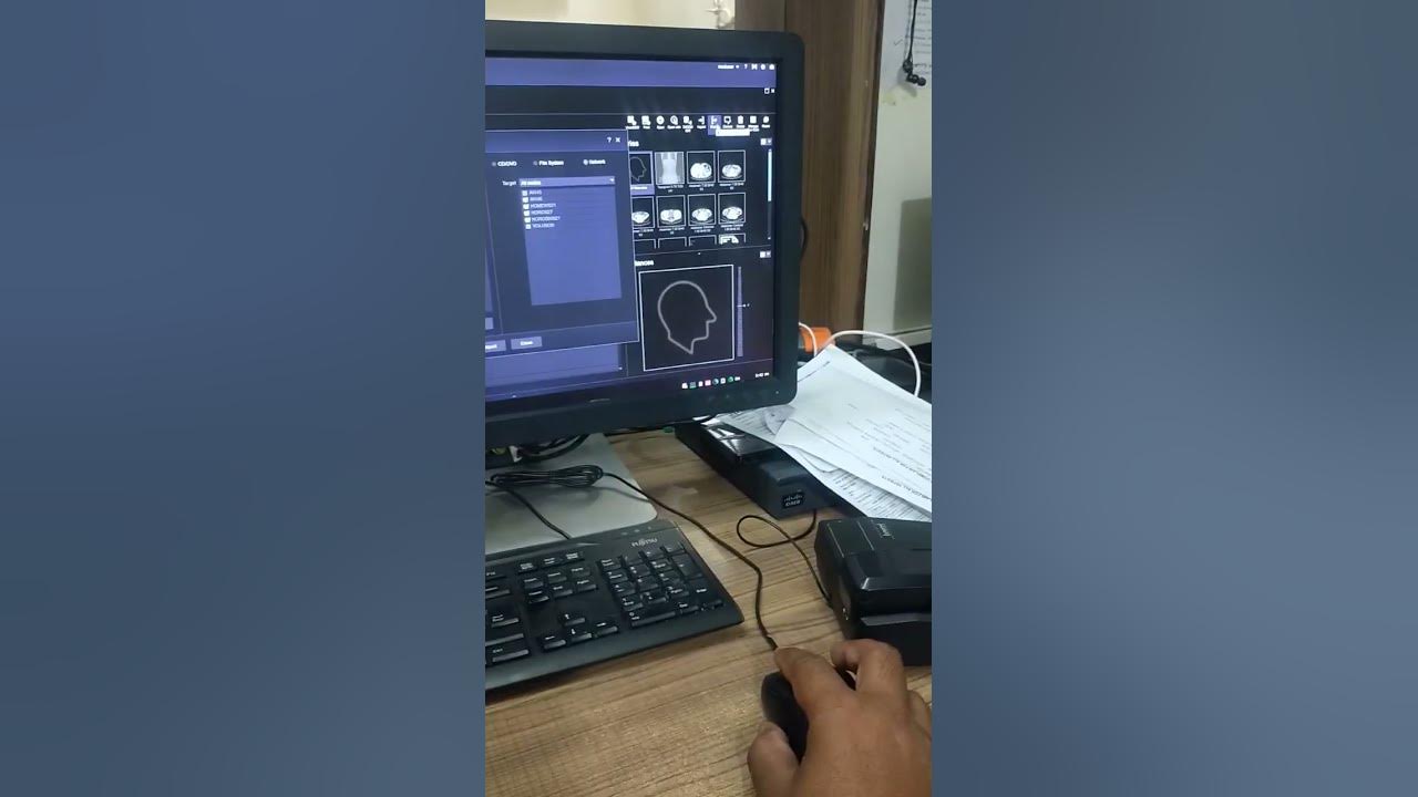 How to send scan on aw45 osirix and aw4 6 transfer scan 