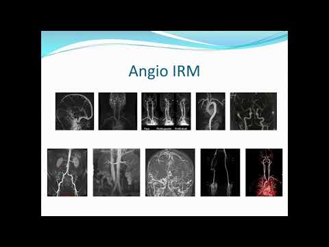 QUEL EXAMEN IRM POUR QUELLE PATHOLOGIE ?