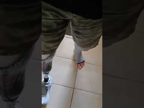 Below Knee Amputee Walking #shortsfeed #viralshorts #youtubeshorts