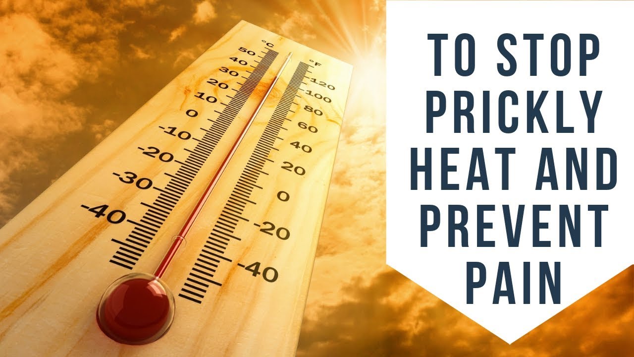 How To Stop Prickly Heat and Prevent Pain Remedies for Prickly Heat