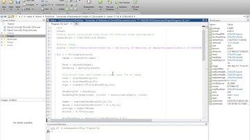 Rat Brain Extraction from T1 MRI using Matlab Image Processing