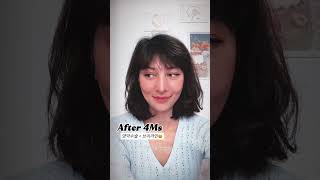 이게 진짜 나야? 양악수술 후 드라마틱한 변화, 지금 확인하세요! 💕