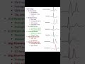ECG Reading | ECG Changes | ECG Report Understand very easily | #norcet2023 #hospitalstaff