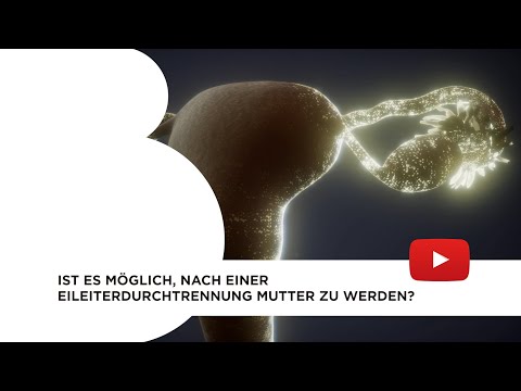 Video: Ist Es Möglich, Nach Einer Eileiterschwangerschaft Schwanger Zu Werden?