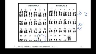 MEIOSIS QUESTION: KYROTYPE: GRADE 12 LIFE SCIENCES BY M.SAID