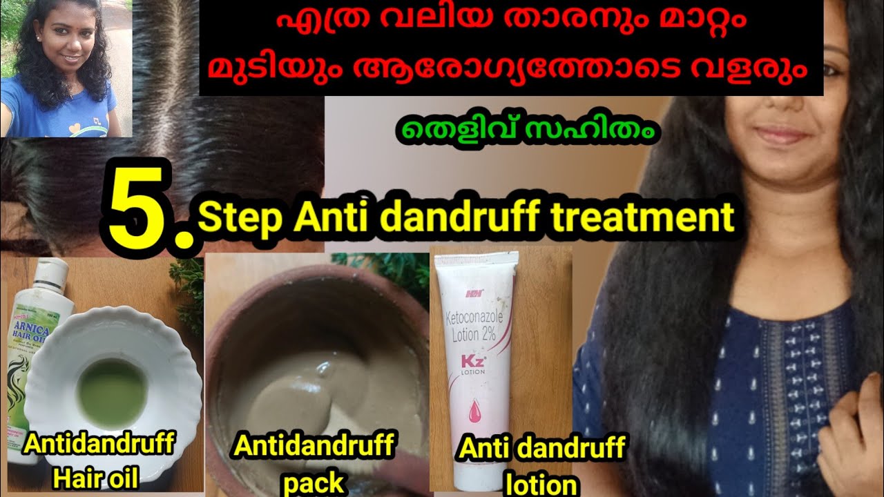 ️Effective 5 step Anti dandruff treatment for healthy hair malayalam fast hair growth silky