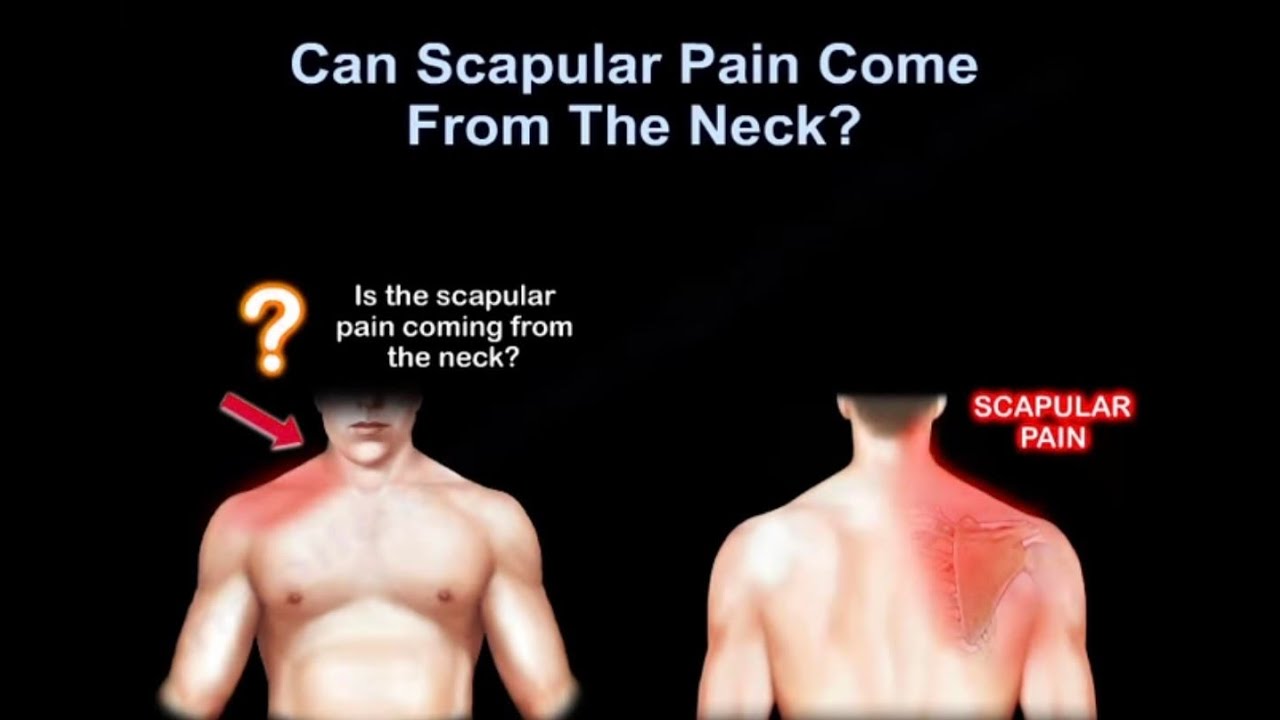 Neck pain or shoulder pain, WHY IT HURTS. 