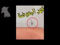 بعوضة عطشانه تحاول تمص دم رجال شوف كيف قهرها 