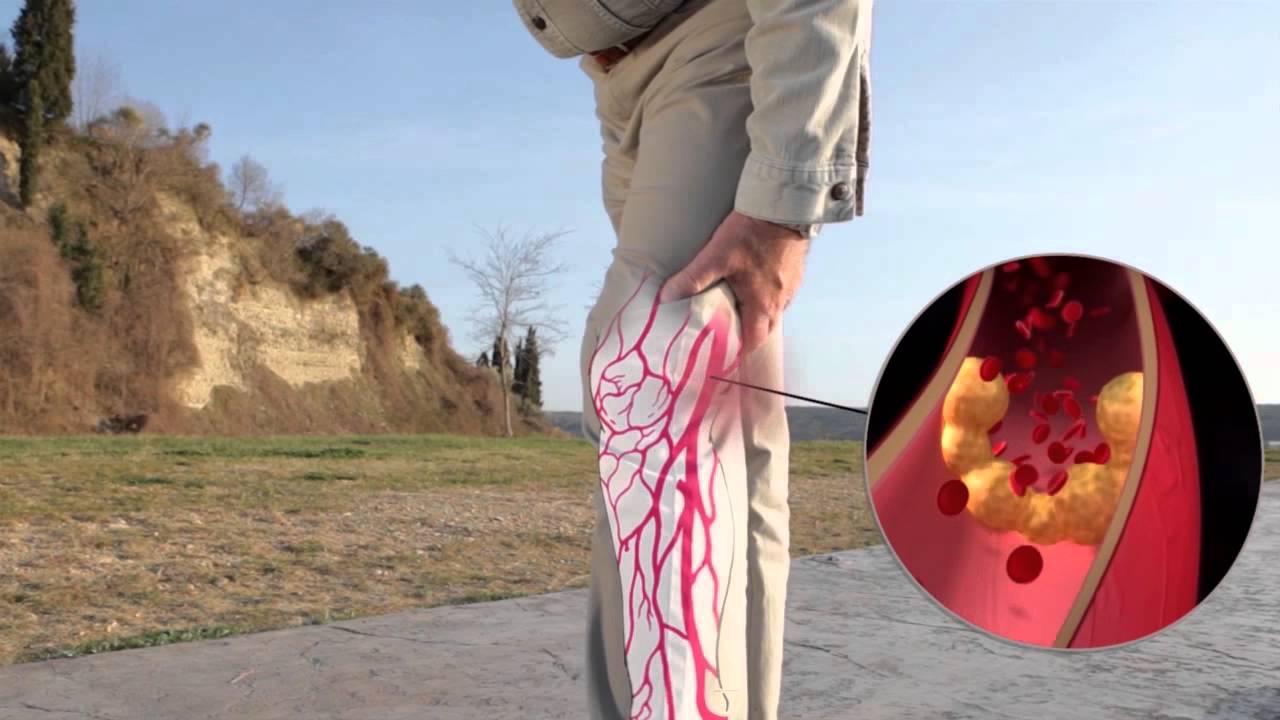 ABPI MD presentation video