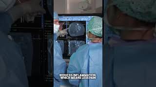 Embolization: The Procedure and How It Helps