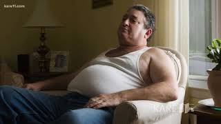 When should you consider weight loss surgery?