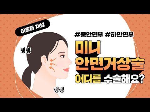 [대전 어울림성형외과] 미니 안면거상술 어디를 수술할까?