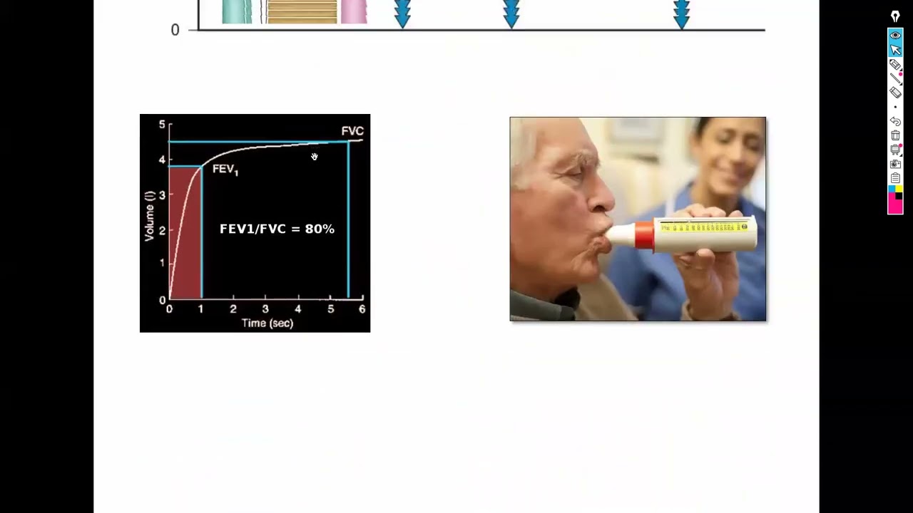 1-Chest Introduction شرح باطنة دكتور سويلم