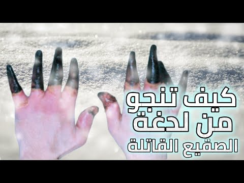 كيف يمكنك النجاة من لسعة الصقيع القاتلة يجب مشاهدته هذا الشتاء 2022 قبل