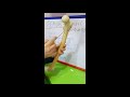 FEMUR - GENERAL FEATURES BY DR MITESH DAVE