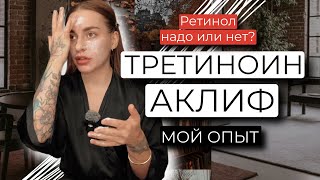 картинка: РЕТИНОЛ, ТРЕТИНОИН, АКЛИФ. МОЙ ОПЫТ 2 ГОДА ИСПОЛЬЗОВАНИЯ