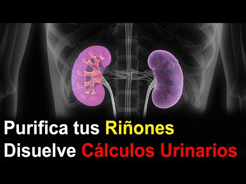 <strong>Limpia</strong> y fortalece tus Riñones inmediatamente con este Remedio Casero
