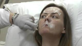 Cosmetic Treatments: Real Life Example - Dermal Fillers (Dr Nick Lowe)