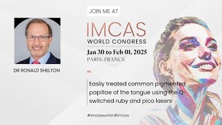 Treatment Of Pigmented Fungiform Papillae Of The Tongue Pfpt With Q-Switched Ruby Laser