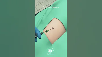 Coronary Angiogram 