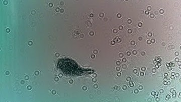 Direct InLine Holographic Microscope  (DIHM)