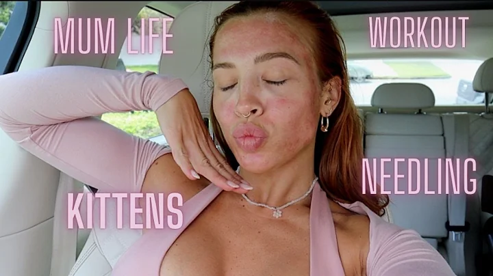 follow me around, kittens, skin needling, workout ...