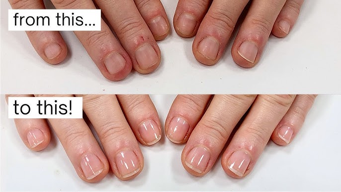 How to Stop Nailbiting: One Trick to Stop Nail Biting · Pint-sized Treasures