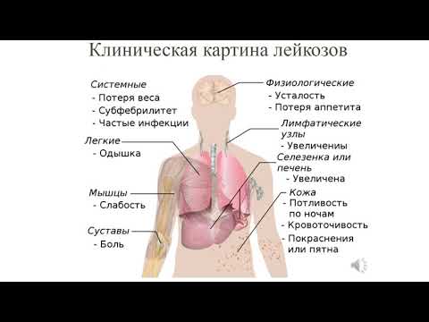 4 курс СФ. Лекция на тему: "Заболевания крови. Гемобластозы".