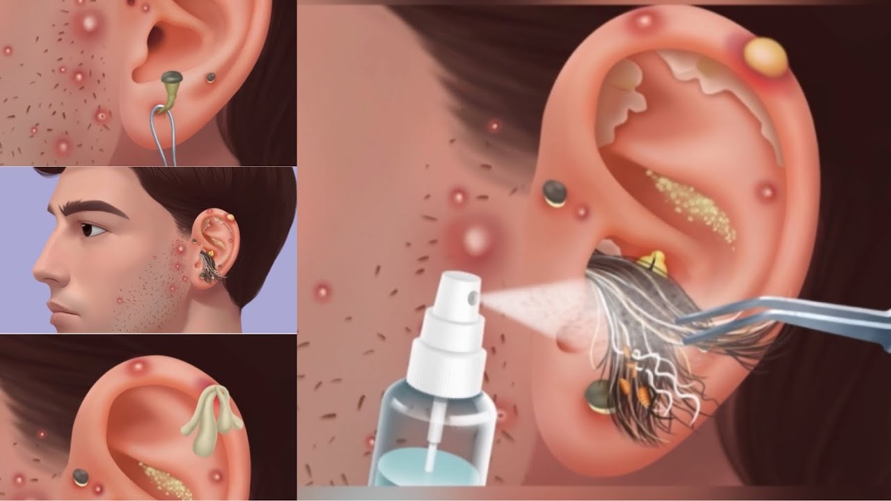 Men Ear Wax Removing ASMRThis is why Ear Cleaning is a MustOddly