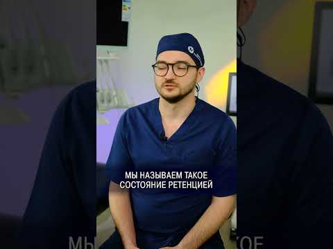 УДАЛЯТЬ ЗУБЫ МУДРОСТИ или НЕТ? #зубы #стоматолог #стоматология