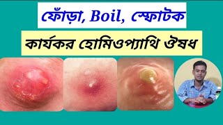 ফোঁড়ার হোমিও ঔষধ ও চিকিৎসা | Boils Treatment In Homeopathy For Bangla | Dr. Muftiur Alnur