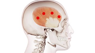 Exploring the Temporalis: Understanding Trigger Point Locations for Better Muscle Health