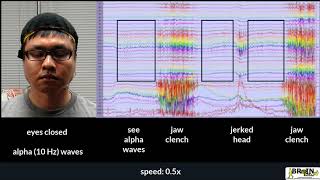 Ucf Brain Lab Eeg Is A Mixture Of Signals