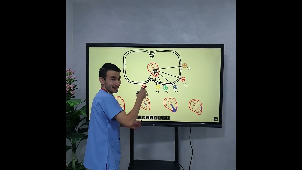 Ko'krak tarmoqlari. Chest leads