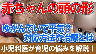 赤ちゃんの頭の形について【小児科医が解説】