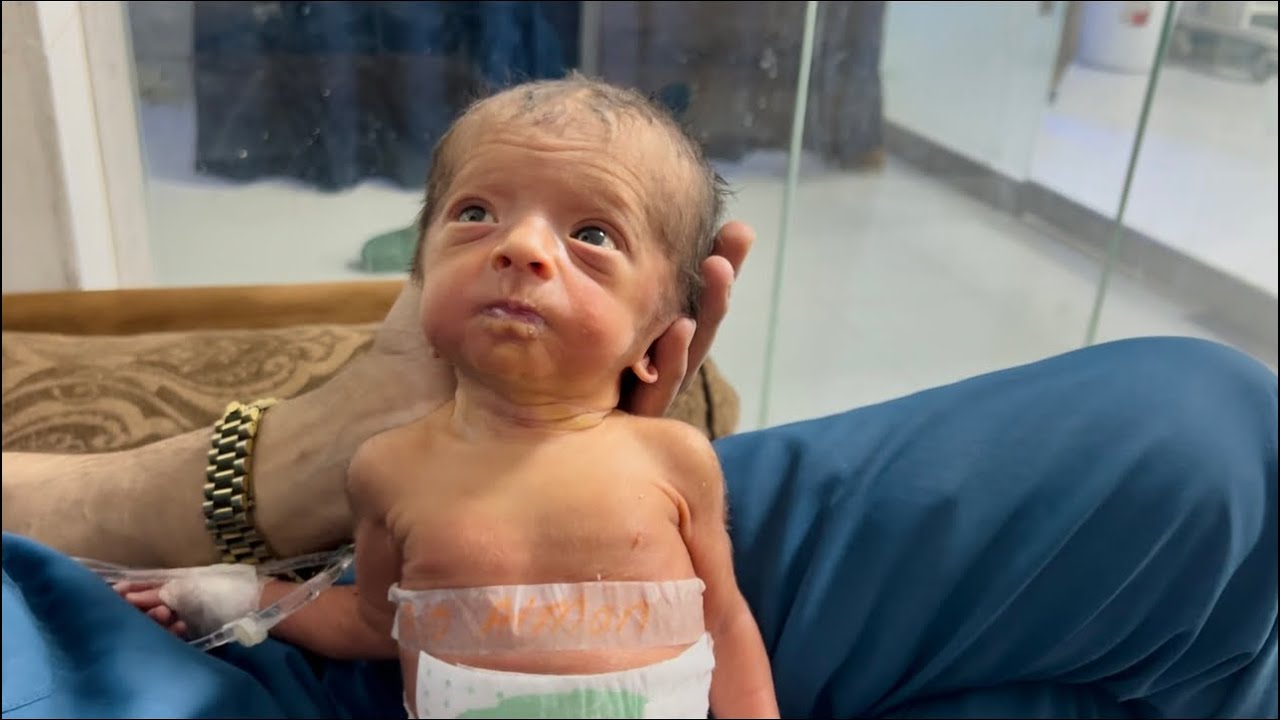 Day 2 NICU Baby Update | Tiny Hydrocephalus Baby Cute Feeding Moments 🤗🍼